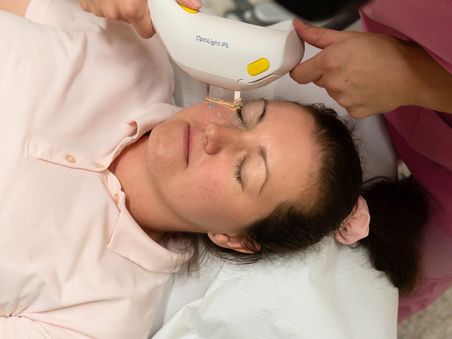 OptiLight oder LipiFlow? Wie ich heute trockene Augen behandle 