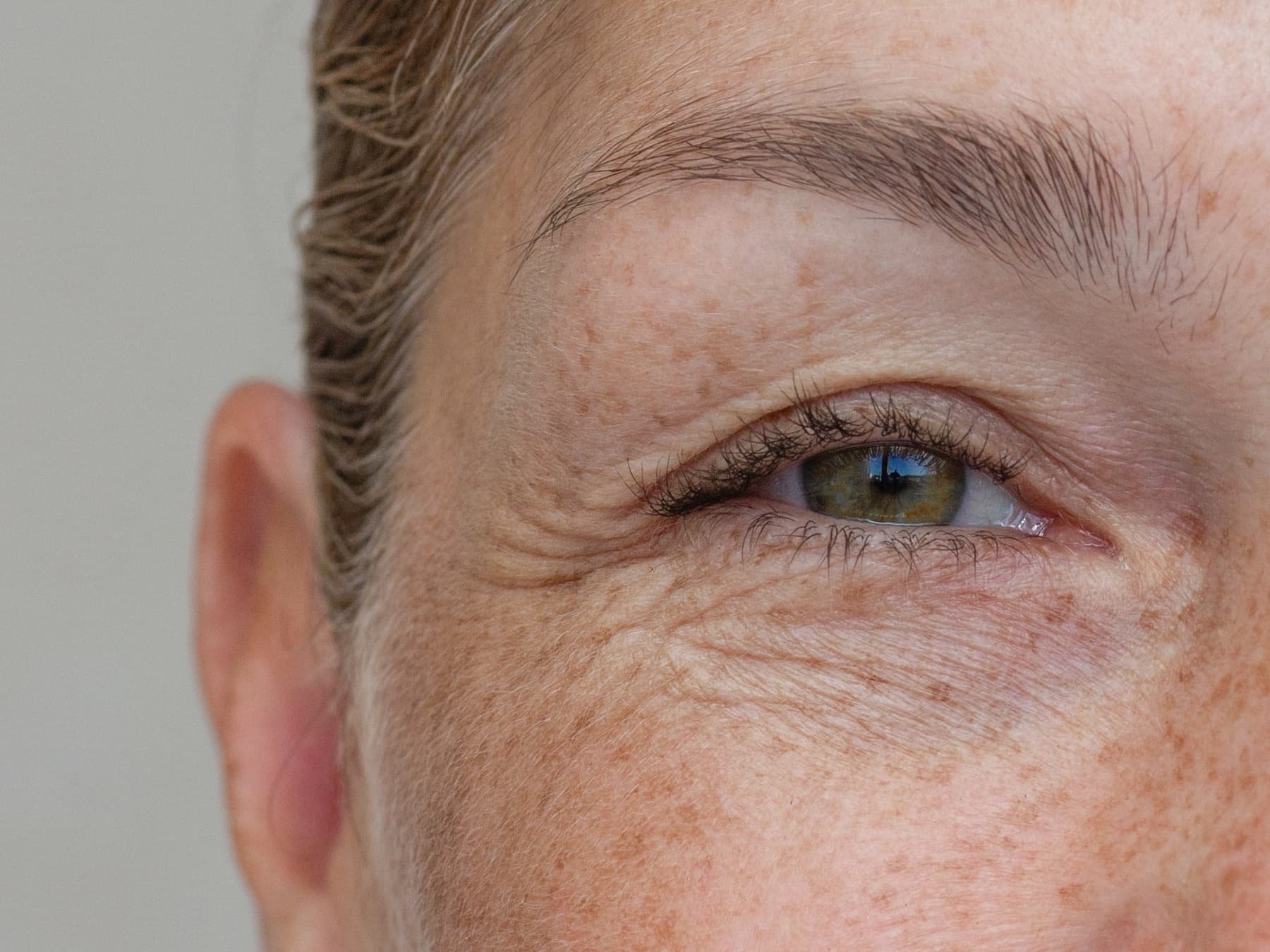 Wann ist der richtige Zeitpunkt für eine chirurgische Korrektur der Augenlider?