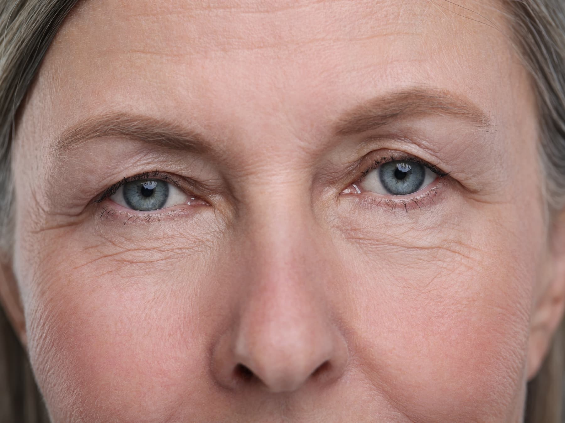 Fünf Fakten über die Operation erschlaffter Augenlider